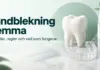 Illustration av en vit tand, en genomskinlig blekskena, blekningsremsor och en blekningspenna med rubriken ”Tandblekning hemma”.